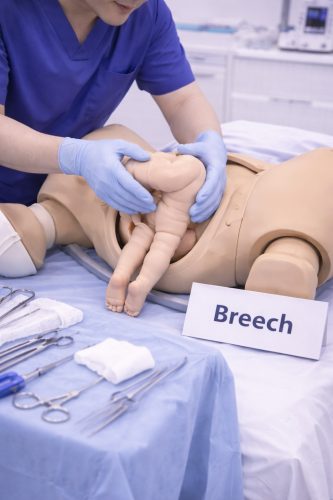 Complex Birth Scenario